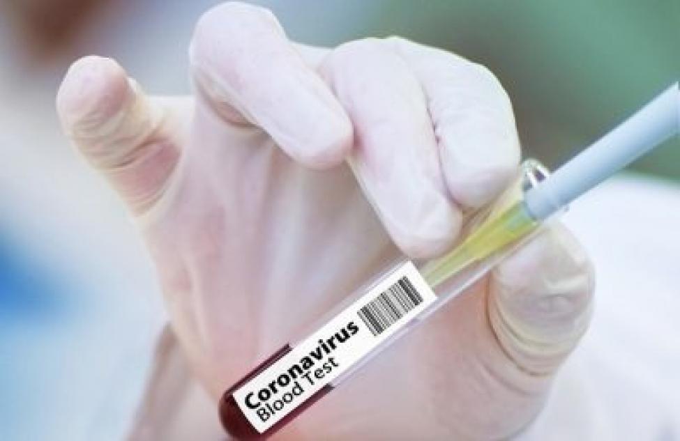 Бердский госпиталь: 22 пациента с коронавирусом находятся в тяжелом состоянии