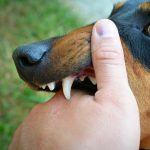 Взыскан моральный вред в пользу укушенного бездомной собакой ребенка